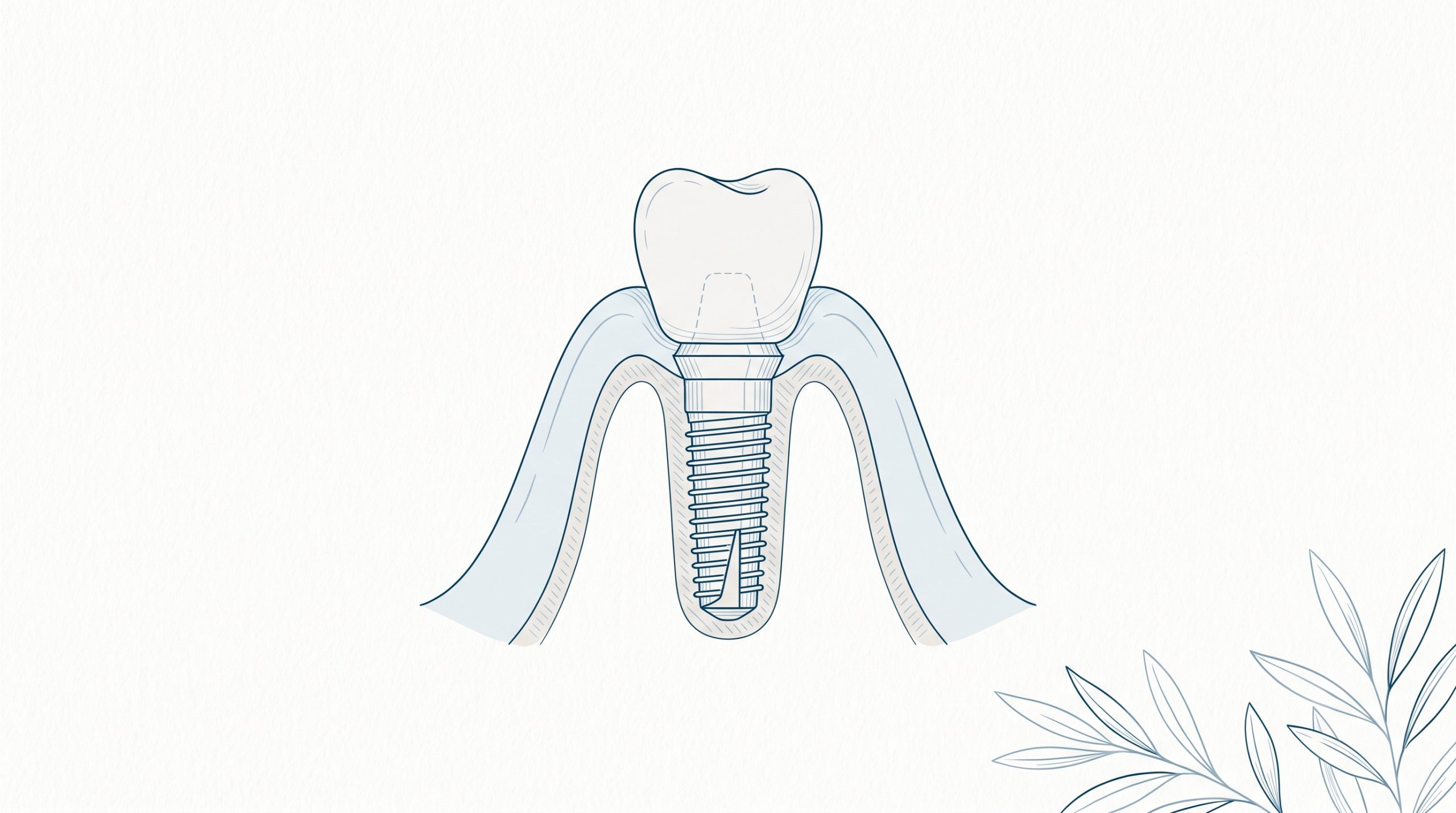What Implantology Dentistry Involves for Missing Teeth